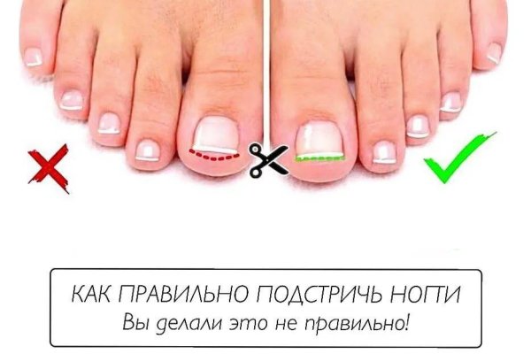 Не получается зайти на кракен